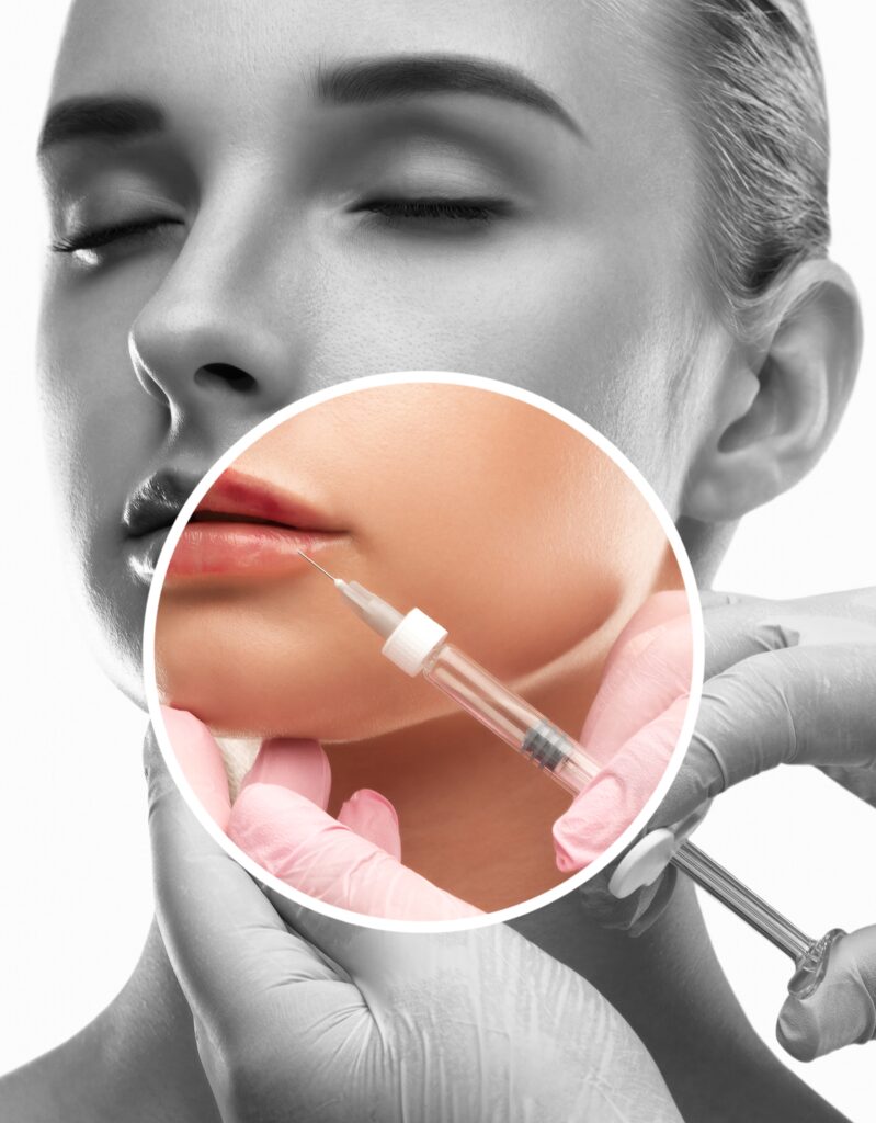 Acid hialuronic | Injectare acid hialuronic - Aesthetictouch